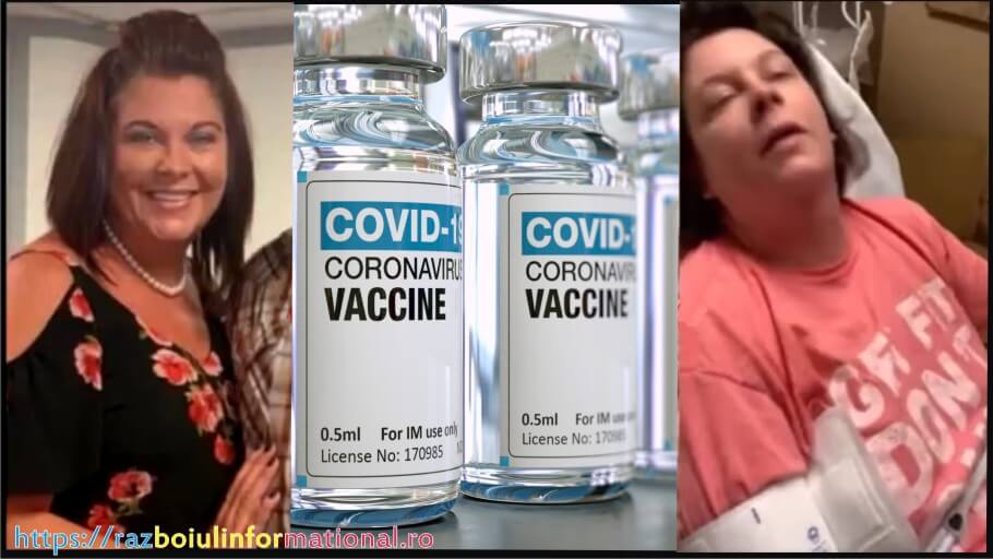 Reacție gravă după vaccinarea anti-Covid cu vaccinul de la Moderna. Cazul Shawn Skelton - Razboiul Informational
